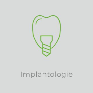 Implantologie - Zahnarztpraxis Ulm